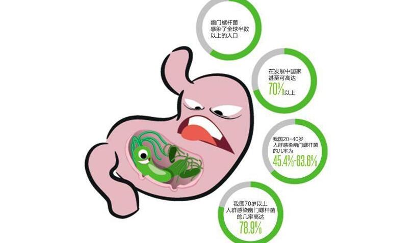 45岁女子感染幽门螺杆菌致胃癌