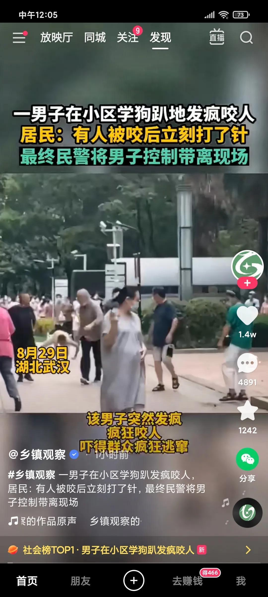 男子疑精神异常在小区学狗叫咬人是怎么回事，关于小区的狗咬人的新消息。