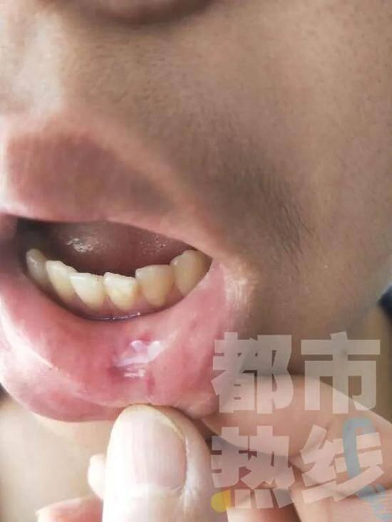 延安一女教师掌掴初二男生被停职怎么回事？曾被评师德