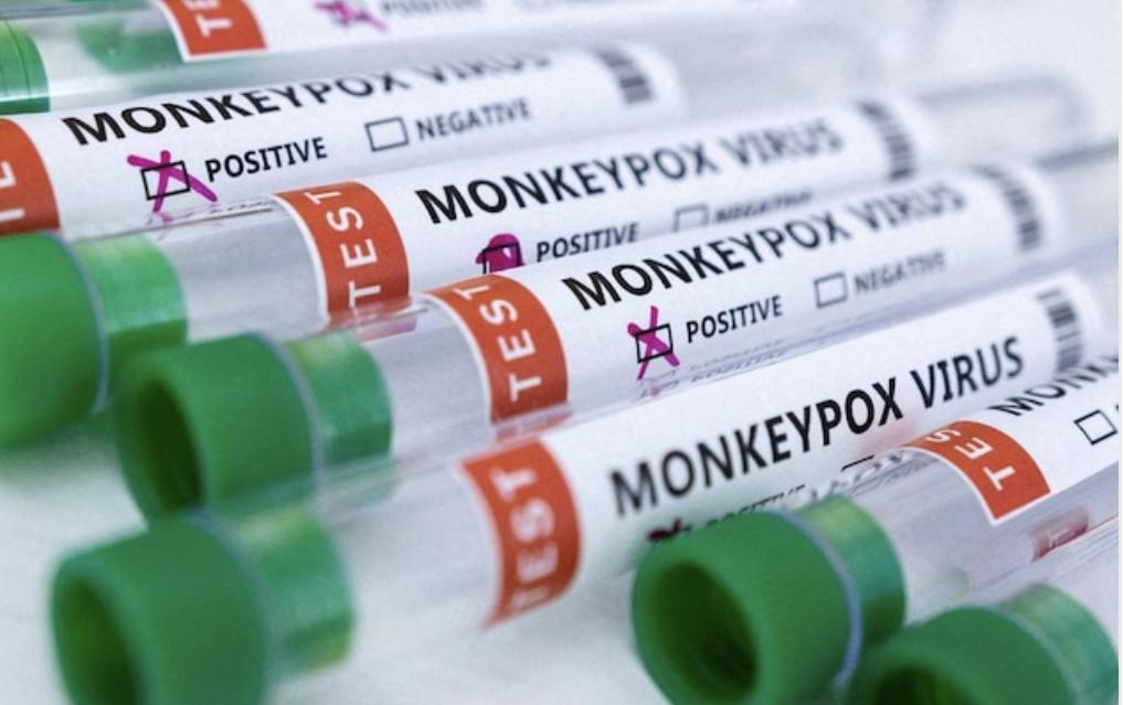 专家谈猴痘疫情出现死亡病例是怎么回事，关于猴痘致死率的新消息。