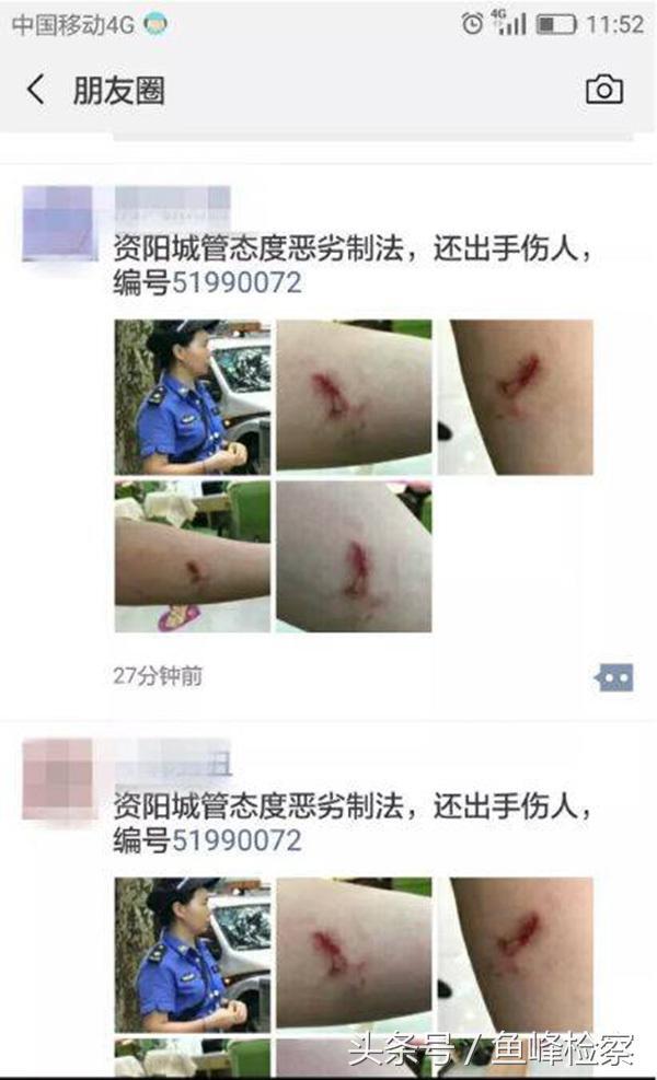 警方回应女城管被打伤痛哭是怎么回事，关于女城管打人的新消息。