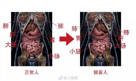 一女子五脏六腑全部反着长是怎么回事，关于五脏六腑长反了的新消息。