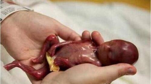 世界上最小的婴儿图片