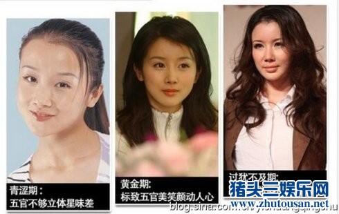 巩新亮领衔整容变残人不像人鬼不像鬼的10大女星（图）