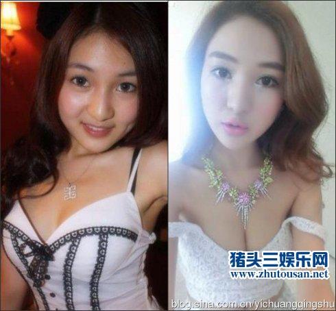 赌博炫富性交易！郭美美整容前后对比照曝光丑出天际