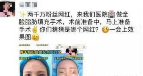 快手吃播猫妹妹怎么了 整容前后照片爆出