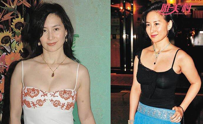 赌王女儿何超琼为什么没有生育 许晋亨和何超琼离婚原因