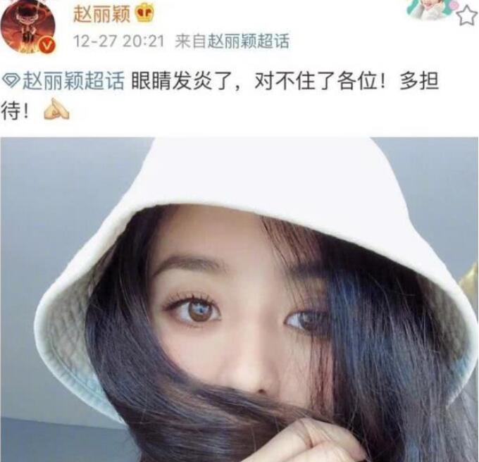 赵丽颖眼睛发炎 不少粉丝也直呼心疼