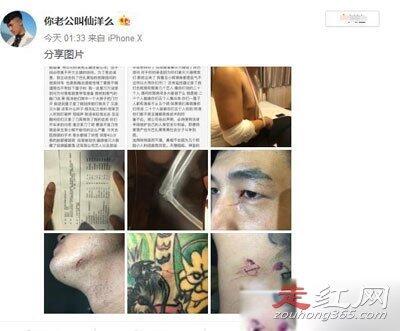 仙洋巴扎黑聊城事件全过程 打架视频是因为什么